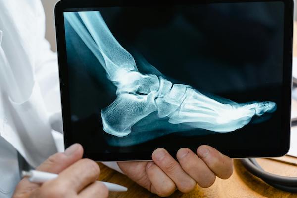 Is podiatry covered by medicare of private health insurance